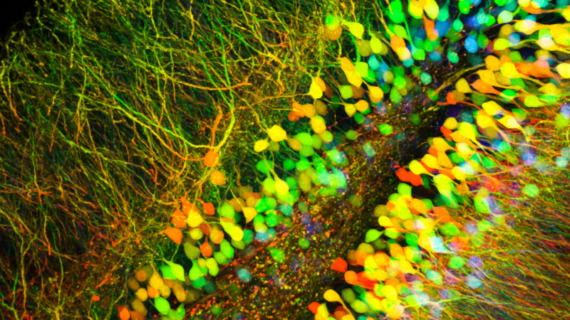 Microscope image